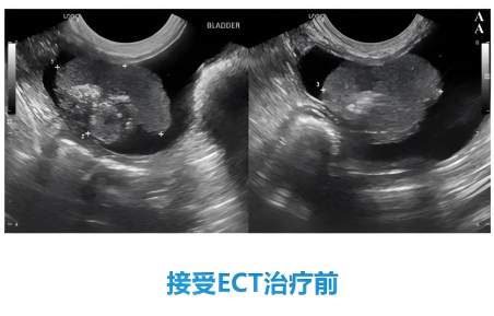 1762225770212295.png 4241083b391e14b3e0ee40c99eecddac.png