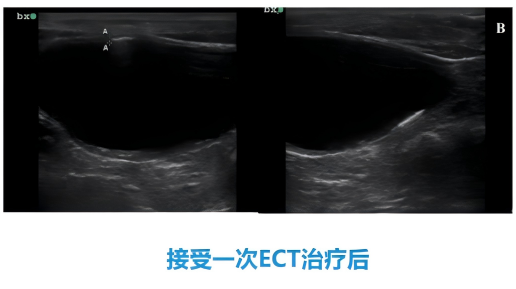 1762225779118764.png 98fec4f38166a0ba25b8f8f8e89fff75.png